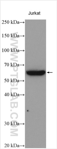 [10419-1-AP-150UL] Calpain 10 Polyclonal antibody