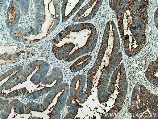 [10421-1-AP-20UL] CEA Polyclonal antibody