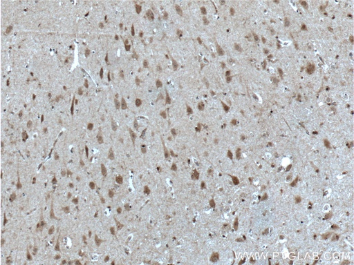 [10422-1-AP-150UL] SOX10 Polyclonal antibody