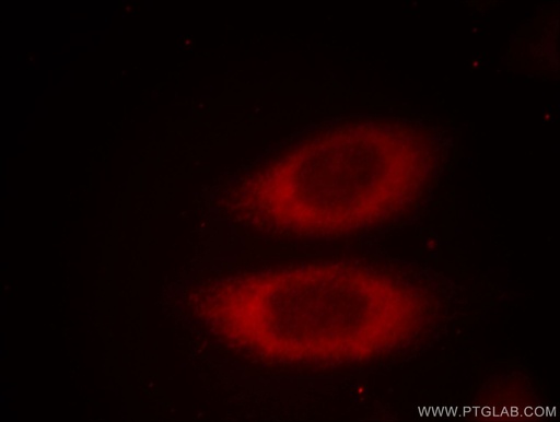 [10424-1-AP-150UL] JTV1 Polyclonal antibody