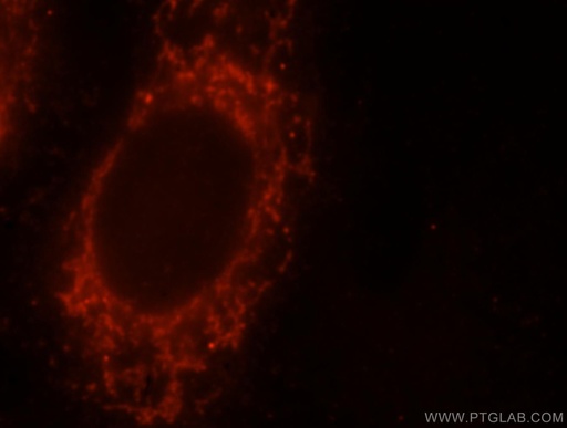 [10425-1-AP-150UL] YY1AP1 Polyclonal antibody