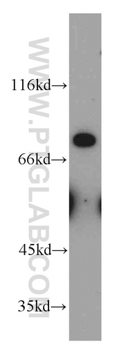 [10428-1-AP-20UL] MFI2 Polyclonal antibody