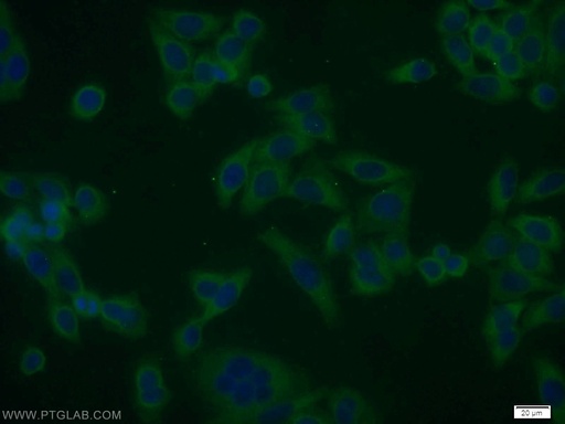 [10429-1-AP-150UL] SMAD1 Polyclonal antibody