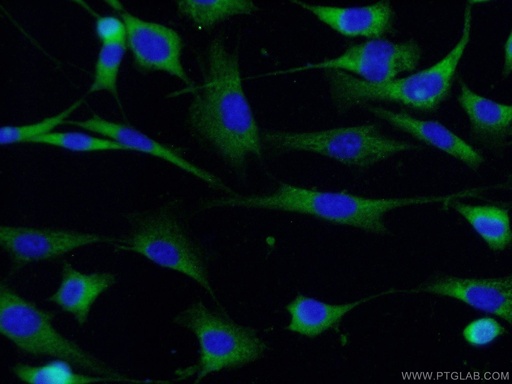 [10430-1-AP-20UL] CDK5 Polyclonal antibody
