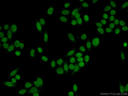 [10431-1-AP-150UL] DDB2 Polyclonal antibody