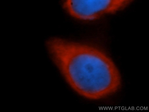 [10439-1-AP-20UL] EIF3J Polyclonal antibody
