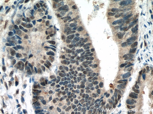 [10441-1-AP-20UL] TORC1/CRTC1 Polyclonal antibody