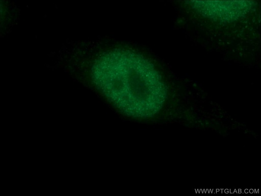 [10442-1-AP-150UL] P53 Polyclonal antibody