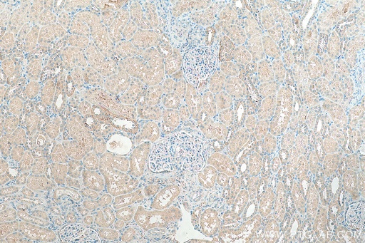 [10444-1-AP-150UL] SLC43A1 Polyclonal antibody