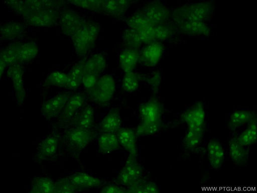 [10448-1-AP-20UL] NOP2 Polyclonal antibody