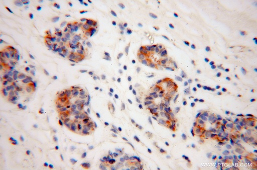 [10450-1-AP-20UL] Connexin-32 Polyclonal antibody