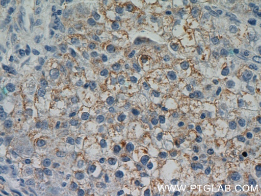 [10452-1-AP-150UL] DSE Polyclonal antibody