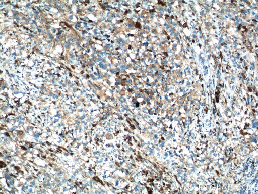[10453-1-AP-20UL] SLC45A2 Polyclonal antibody