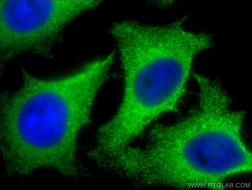 [10455-1-AP-20UL] CLTB Polyclonal antibody