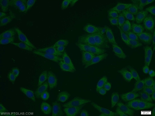 [10456-1-AP-150UL] NELF-A Polyclonal antibody