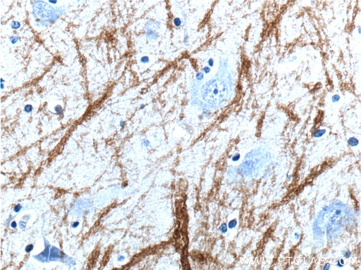 [10458-1-AP-150UL] Myelin basic protein Polyclonal antibody