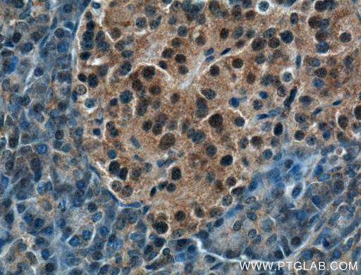 [10464-1-AP-150UL] COPS4 Polyclonal antibody