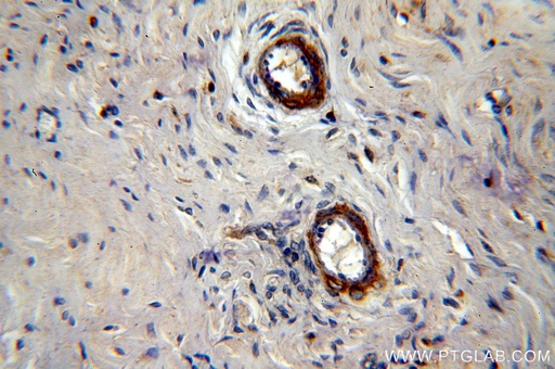 [10465-1-AP-150UL] LAMA4 (Isoform 3) Polyclonal antibody