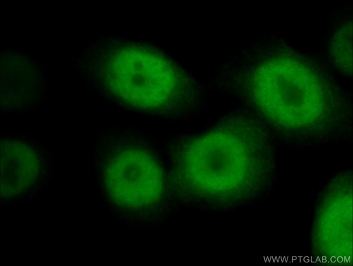 [10469-1-AP-20UL] RAN Polyclonal antibody