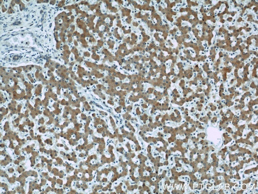 [10471-1-AP-20UL] Seladin 1 Polyclonal antibody