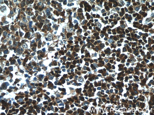 [10475-1-AP-20UL] TCL1A Polyclonal antibody