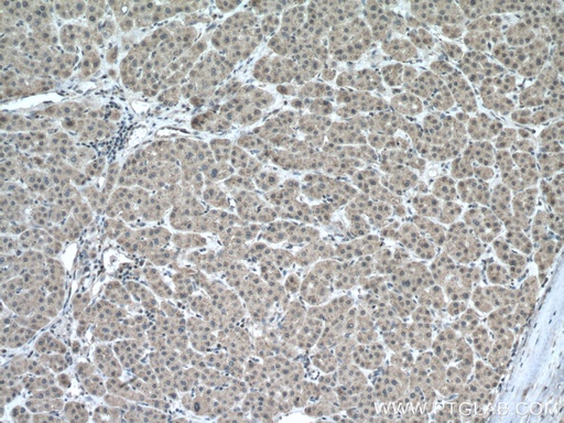[10477-1-AP-20UL] CHMP2A Polyclonal antibody