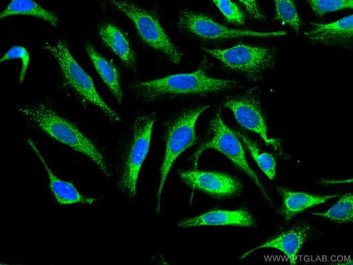 [10479-2-AP-150UL] Annexin A11 Polyclonal antibody