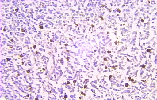 [10480-1-AP-20UL] Prothymosin Alpha Polyclonal antibody
