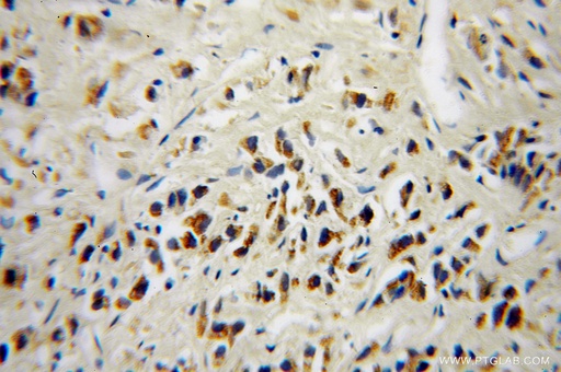 [10481-2-AP-150UL] DOK4 Polyclonal antibody