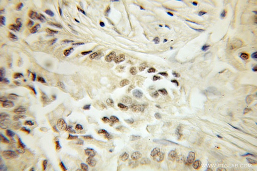 [10482-1-AP-150UL] SF3B4 Polyclonal antibody