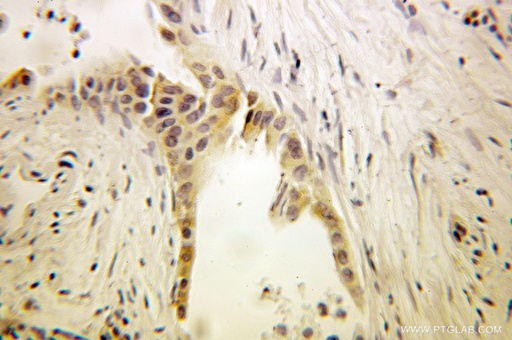 [10483-1-AP-150UL] EEF1B2 Polyclonal antibody
