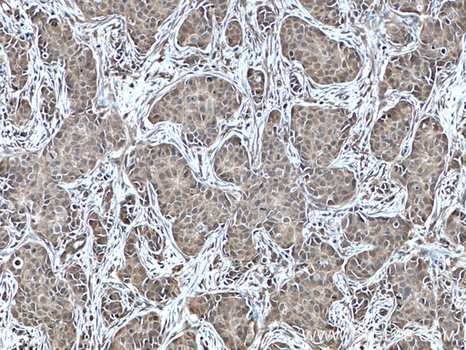 [10484-1-AP-20UL] NUDT2 Polyclonal antibody