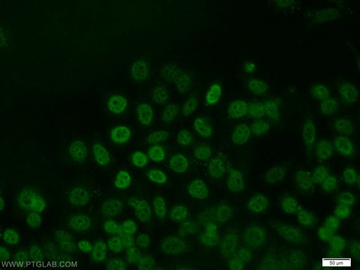 [10486-1-AP-150UL] JUNB Polyclonal antibody