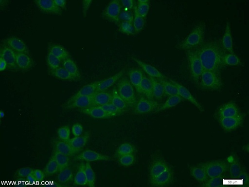 [10487-1-AP-150UL] STARD5 Polyclonal antibody