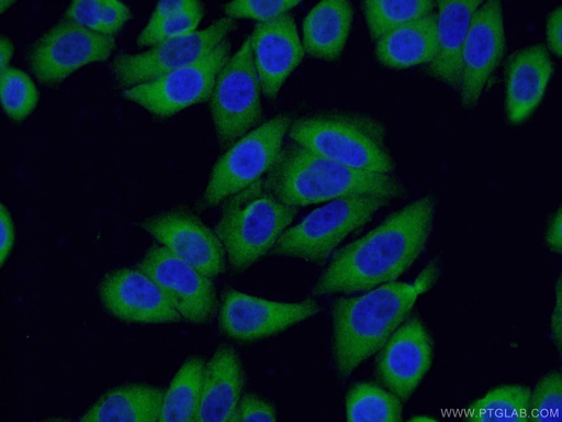 [10489-1-AP-20UL] S100A14 Polyclonal antibody