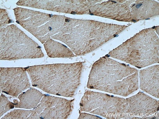 [10492-1-AP-150UL] Calpain 3 Polyclonal antibody