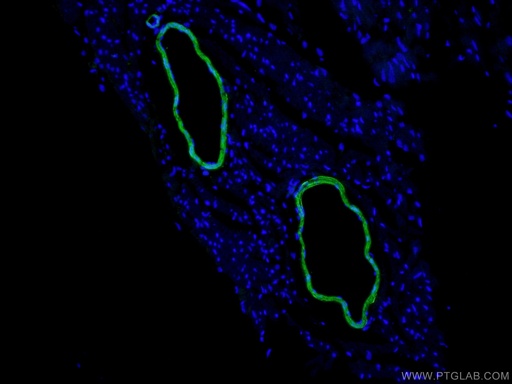 [10493-1-AP-150UL] transgelin/SM22 Polyclonal antibody