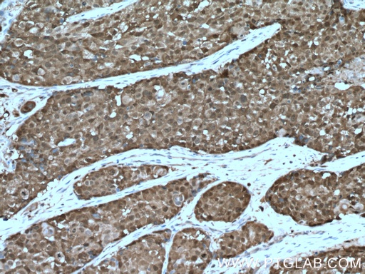 [10500-1-AP-150UL] ASC/TMS1 Polyclonal antibody