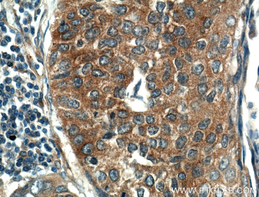 [10503-2-AP-150UL] KEAP1 Polyclonal antibody