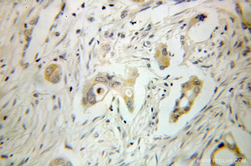 [10505-1-AP-150UL] GSTA2 Polyclonal antibody