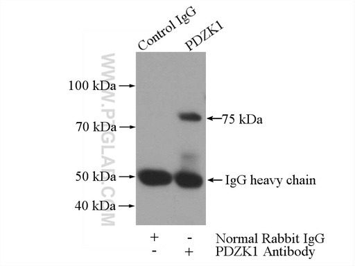 [10507-2-AP-20UL] PDZK1 Polyclonal antibody