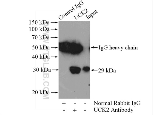 [10511-1-AP-150UL] UCK2 Polyclonal antibody