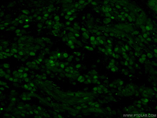[10513-1-AP-150UL] MCM2 Polyclonal antibody