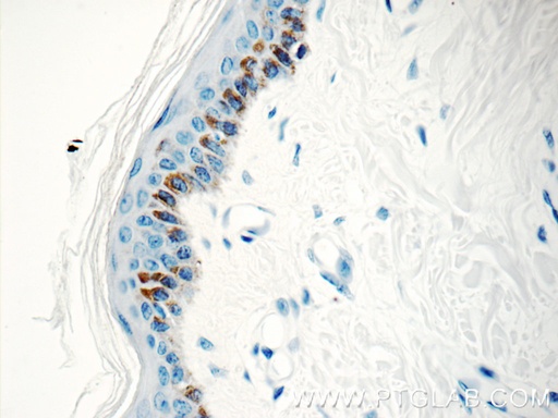 [10514-2-AP-20UL] Kallikrein 5 Polyclonal antibody
