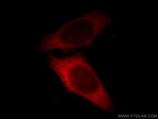 [10515-1-AP-150UL] LASP1 Polyclonal antibody