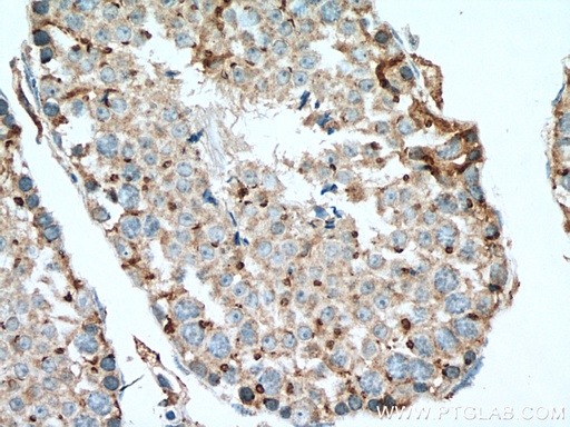 [10517-1-AP-150UL] SDF4 Polyclonal antibody