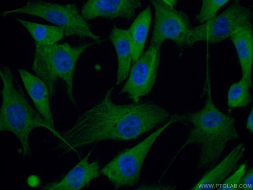 [10518-2-AP-150UL] PACSIN2 Polyclonal antibody