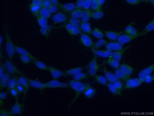 [10519-1-AP-150UL] PCMT1 Polyclonal antibody