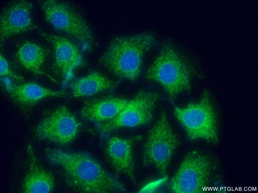 [10525-1-AP-150UL] CRMP5 Polyclonal antibody