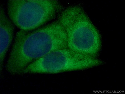 [10527-1-AP-150UL] NRG1 Polyclonal antibody
